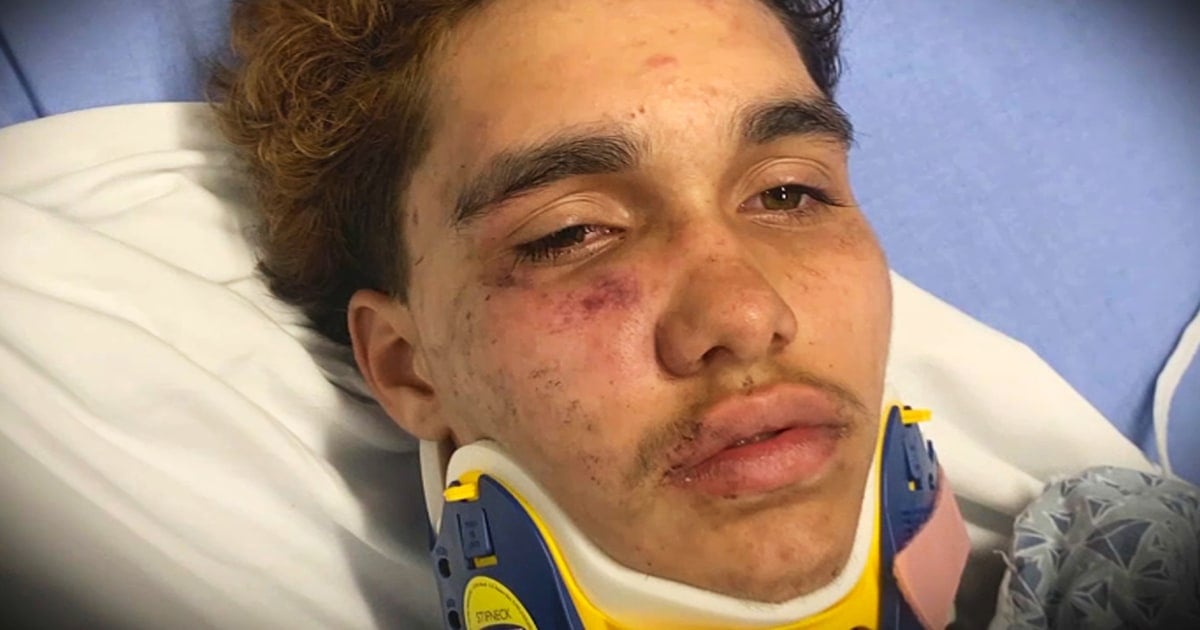 Transgender boy, 16, beaten by large group of teens in Massachusetts