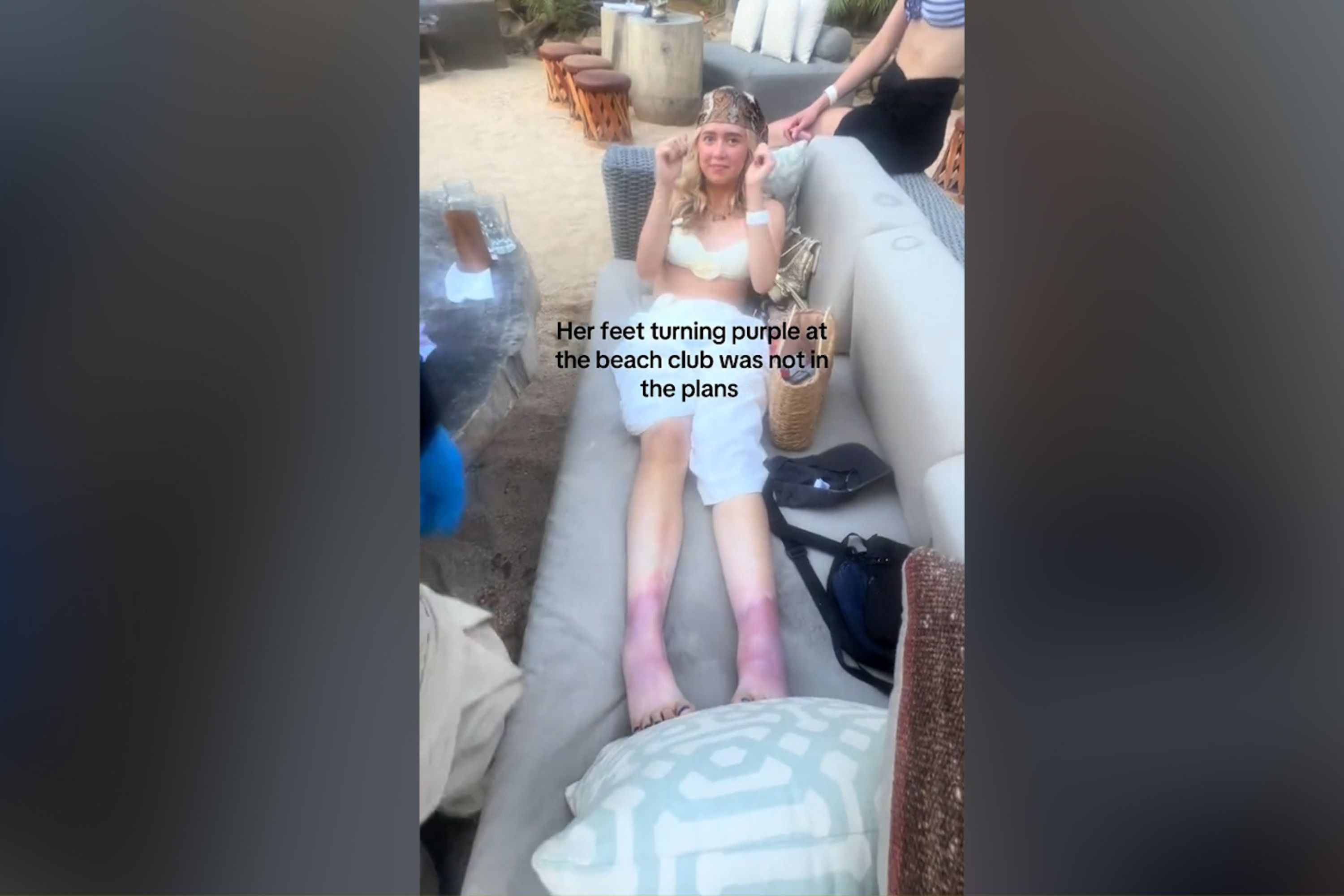 American Woman's Feet Mysteriously Turn Purple on Vacation in Mexico