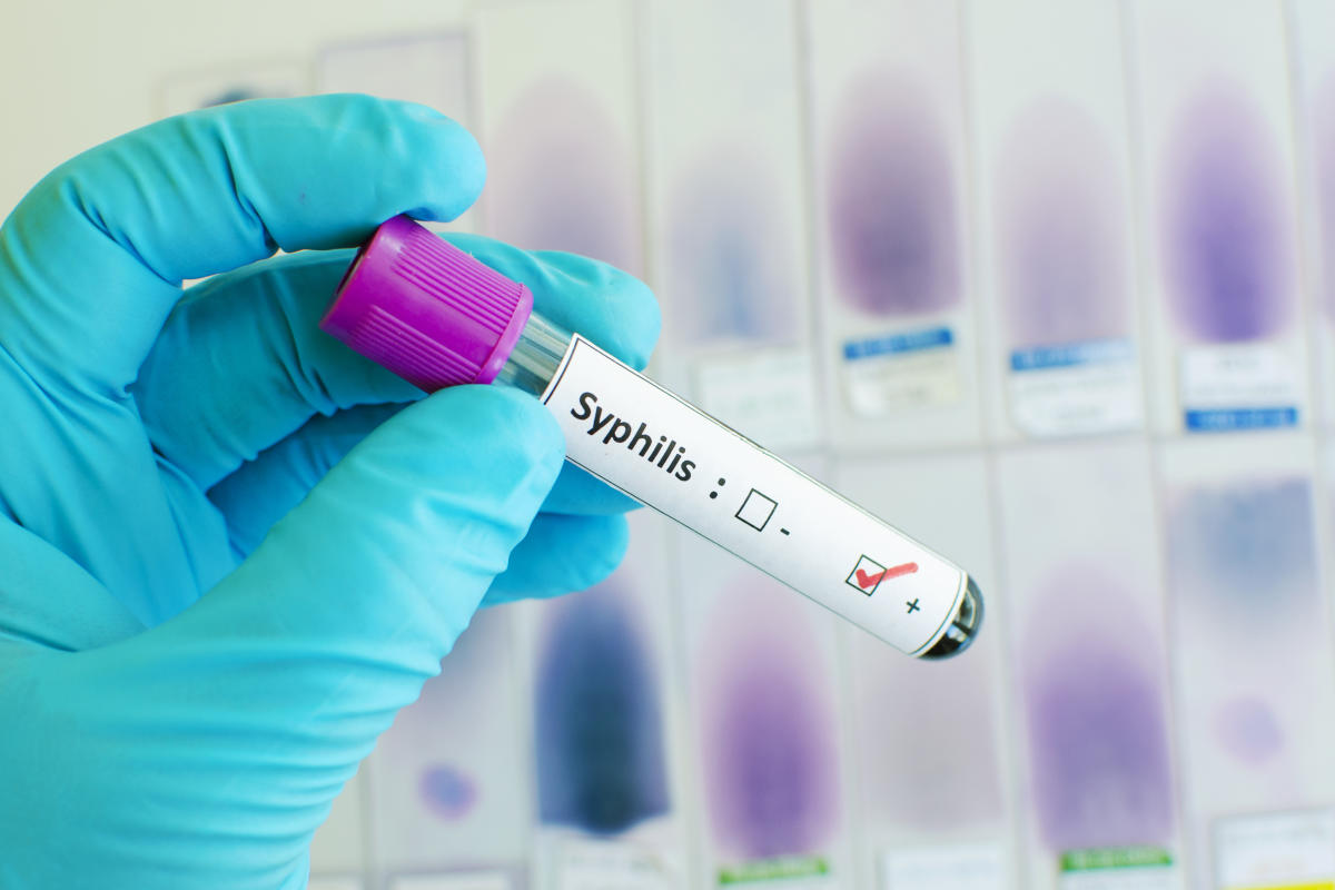 Syphilis cases are on the rise. The FDA just approved a home test that could combat that.