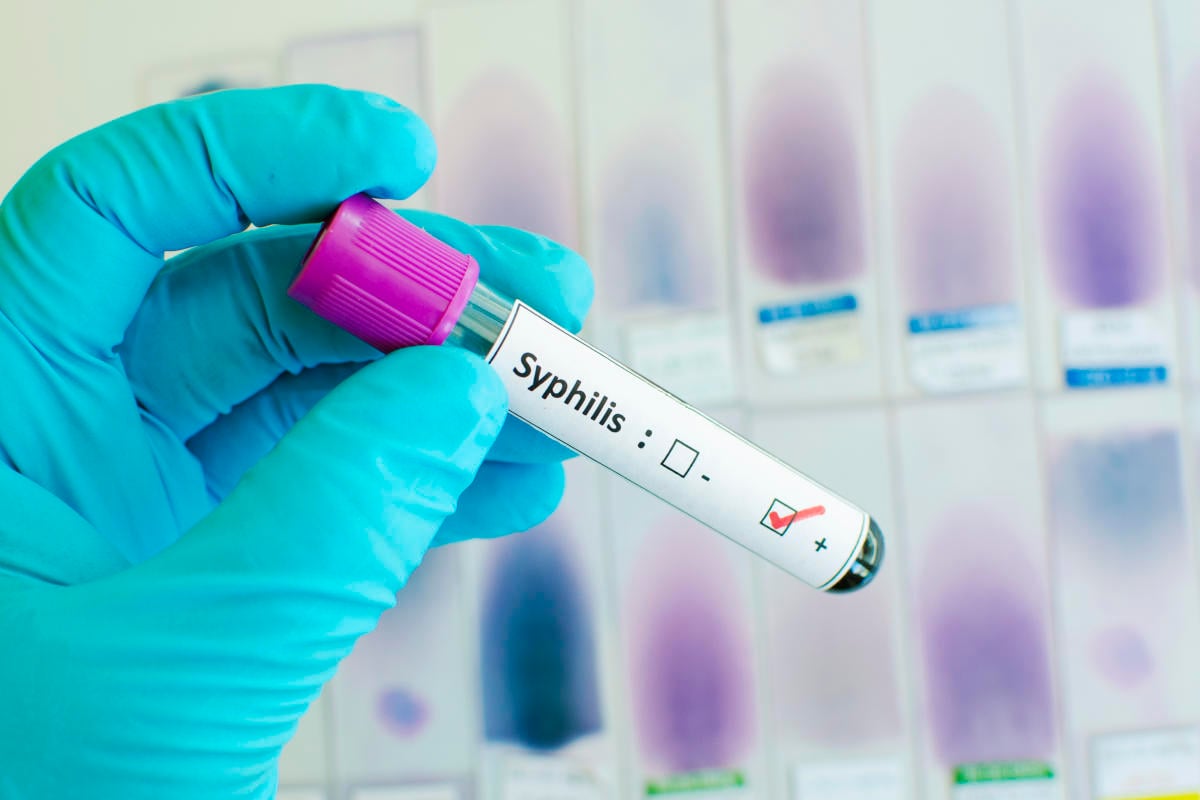 Syphilis cases are on the rise. The FDA just approved a home test that could combat that.