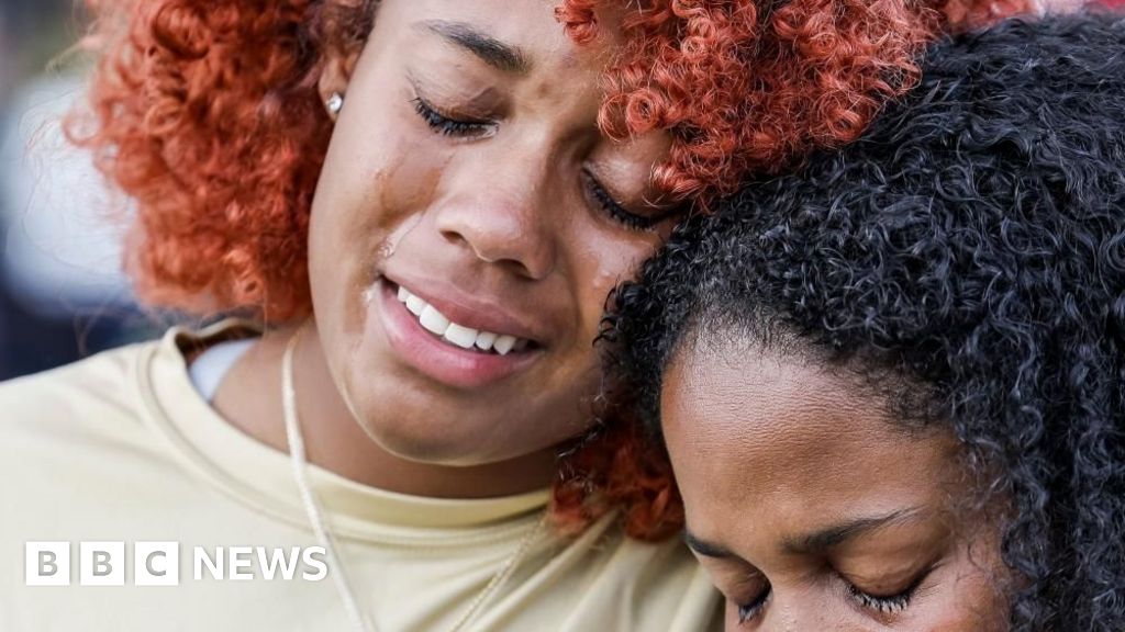 After a brain bleed, a Georgia hospital temporarily removed part of a man’s skull. Employees lost the bone, lawsuit says