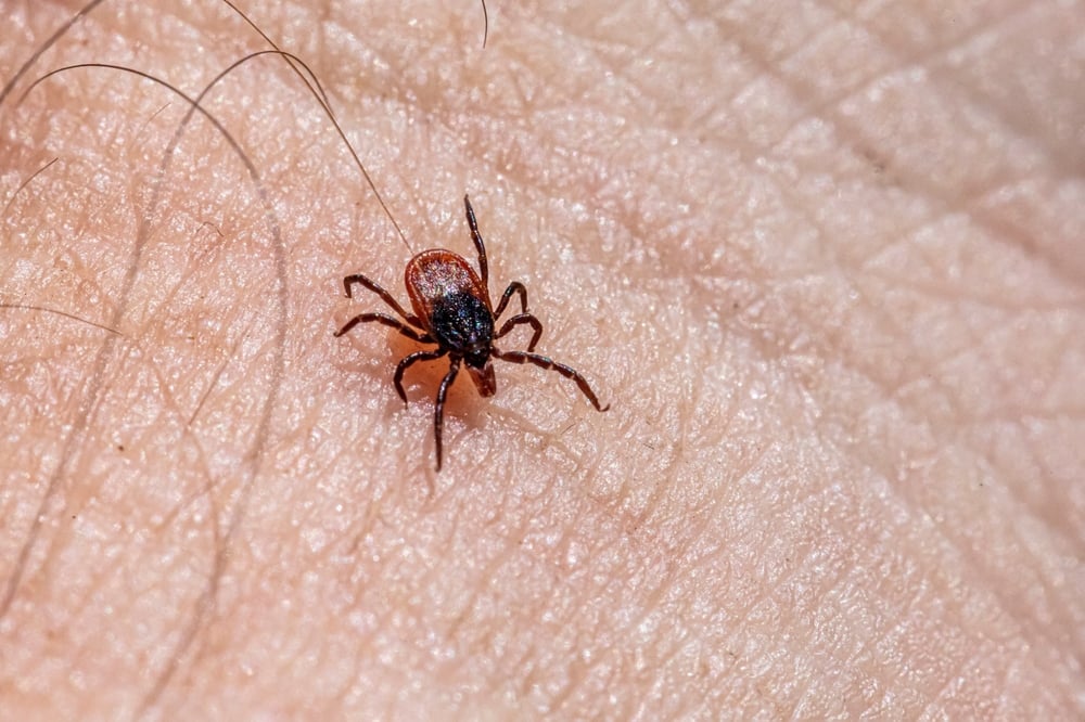 Connecticut has first human case of rare tick-borne disease