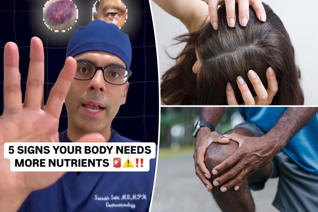 Doctor reveals 5 signs your body needs more nutrients