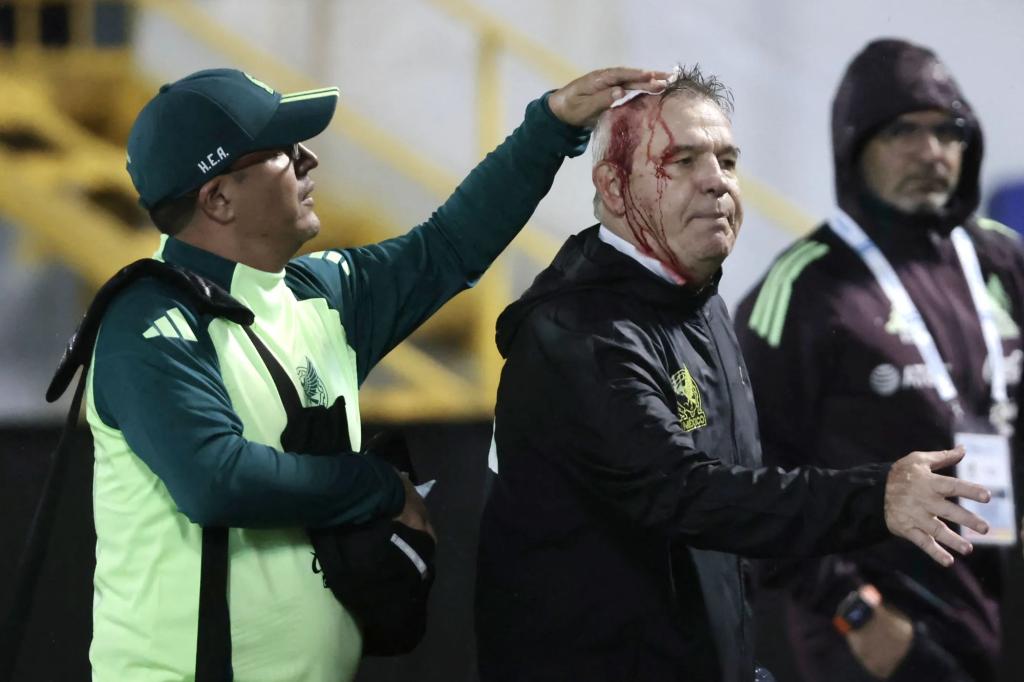 Mexico soccer coach Javier Aguirre injured after being hit in head by apparent beer can that was thrown from the stands