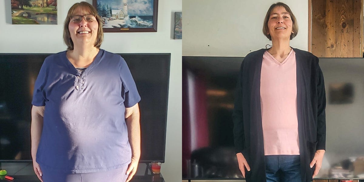 I lost half my weight in 3 years. I have body dysmorphia from all the loose skin I have.