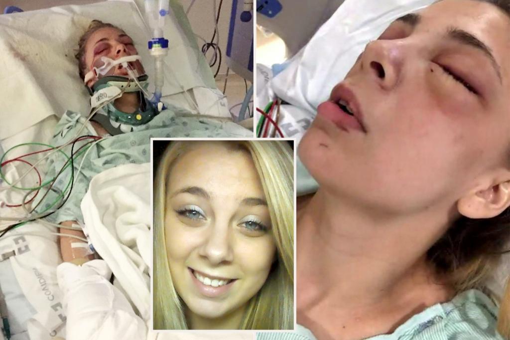 Ex-meth user who gouged her own eyeballs out while high says she is ‘happier’ years after nightmarish episode