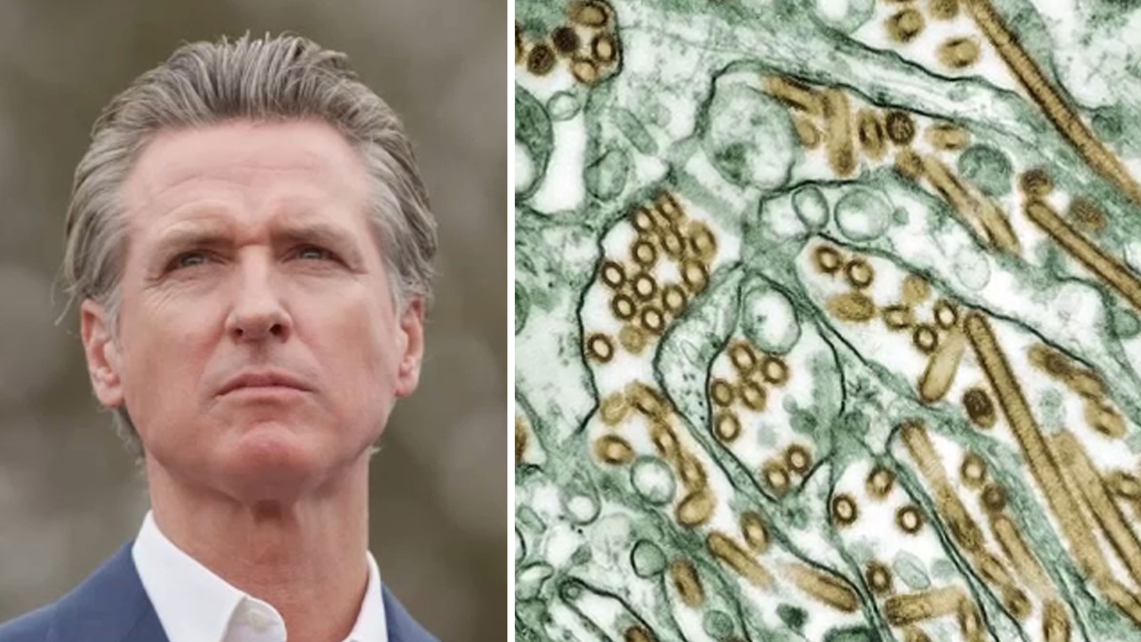 Gov. Gavin Newsom declares state of emergency in response to bird flu