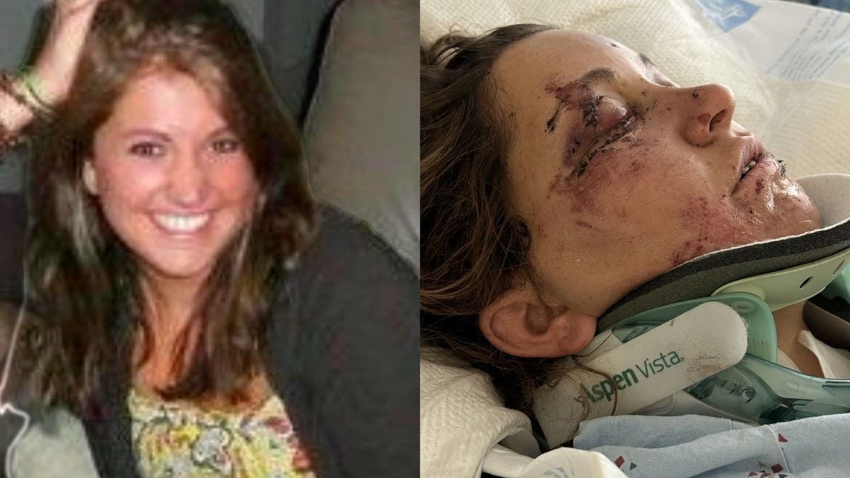 Southern Colorado woman recovering from brutal attack in Huntington Beach