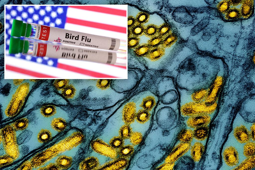 Health officials say Louisiana patient is first severe bird flu case in US