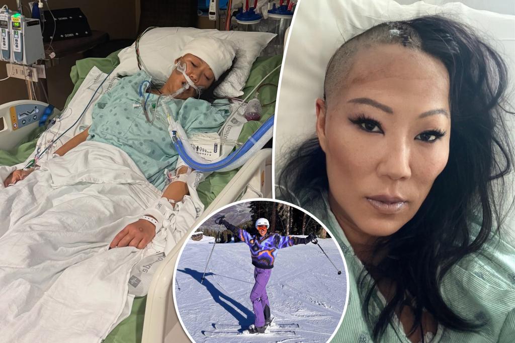 ‘Bling Empire’ star Lynn Ban has brain surgery after skiing accident