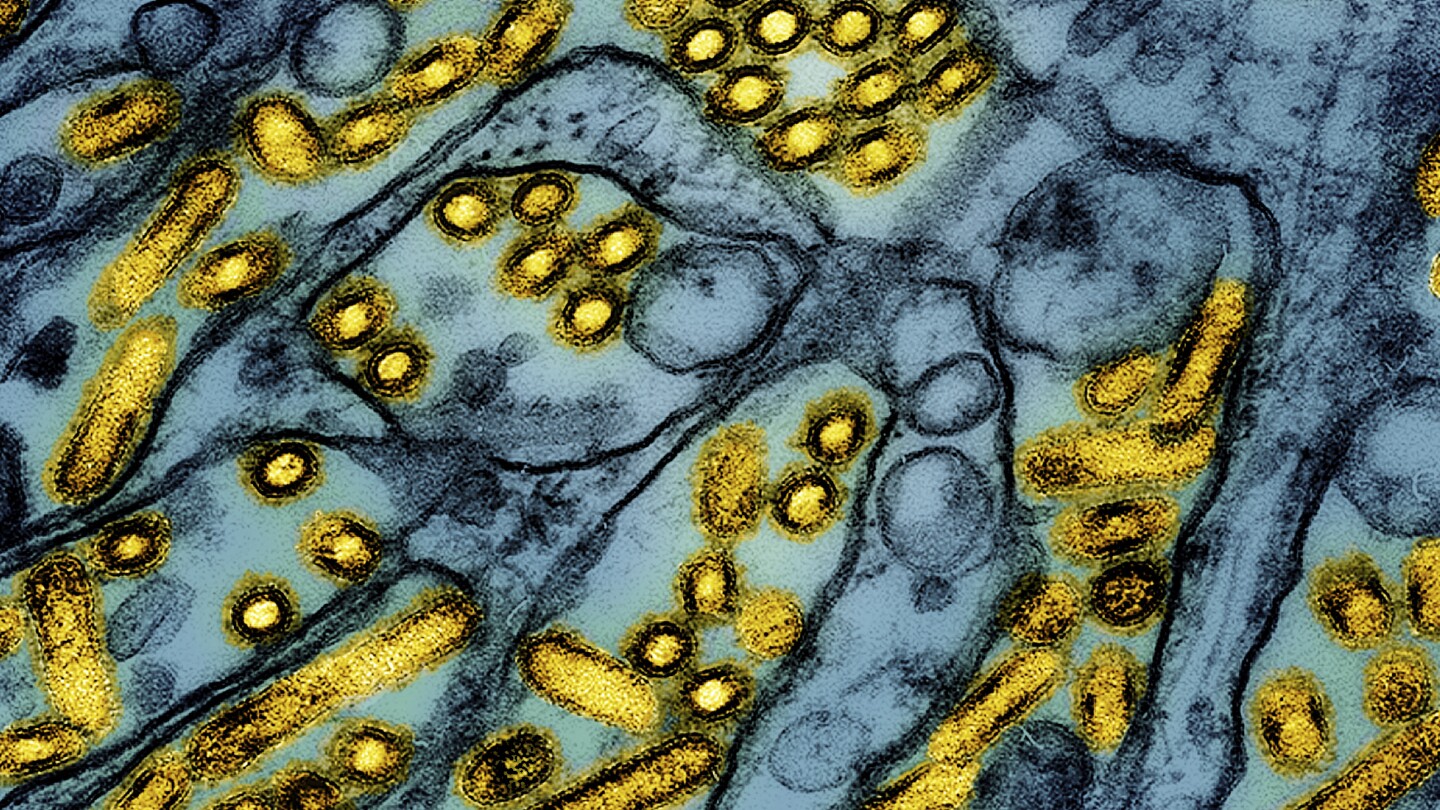 Louisiana person is the first US bird flu death