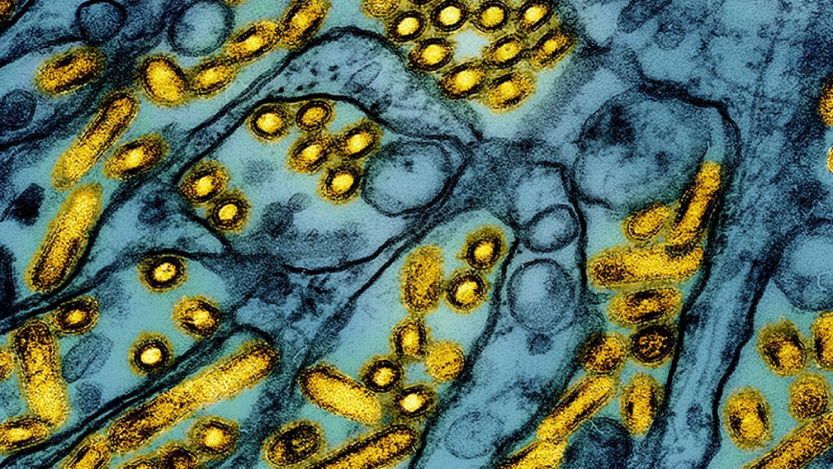 US identifies 65-year-old in Louisiana as first severe case of bird flu