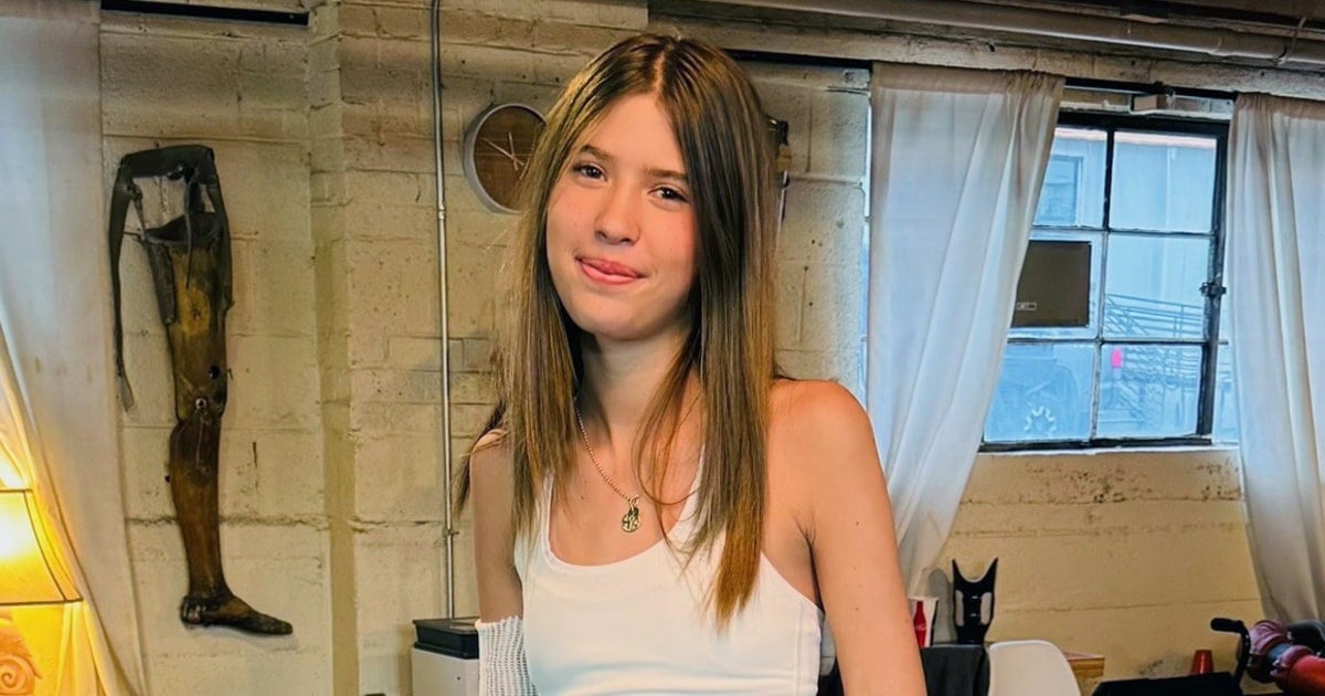 Colorado teen who lost leg in shark attack on Belize diving trip says she's 'lucky' to be alive