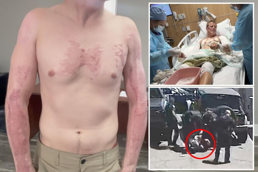 Man suffers burns after cops 'cooked' his skin on hot asphalt: complaint