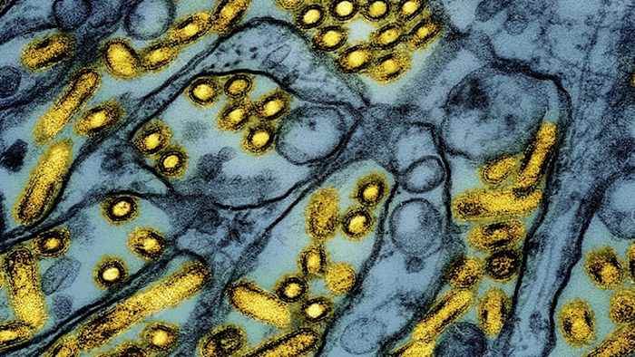 Michigan Department of Agriculture confirms case of bird flu in Oakland County